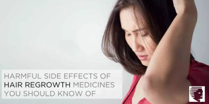 Harmful Side Effects of Hair Regrowth Medicines You Should Know of