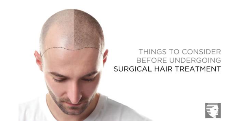 Things to Consider Before Undergoing Surgical Hair Treatment