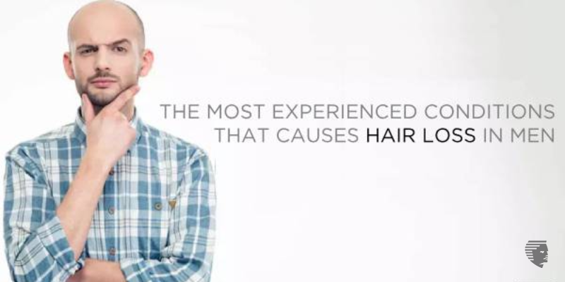 THE MOST EXPERIENCED CONDITIONS THAT CAUSES HAIR LOSS IN MEN