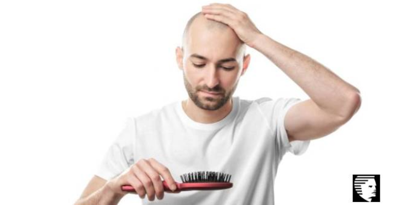TOP 7 MYTHS ABOUT HAIR LOSS AND BALDING