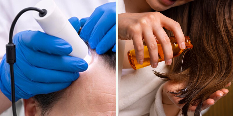 Hair Loss Solutions: Exploring Laser Therapy and Traditional Methods