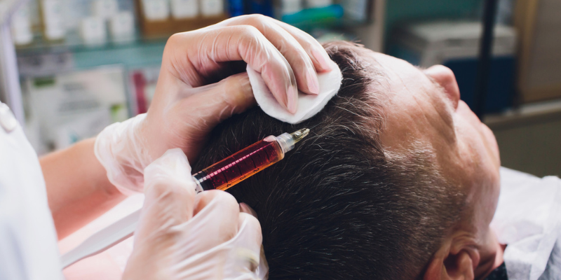 Hair Transplant vs. Non-Surgical Hair Replacement: Pros, Cons, and What You Should Know