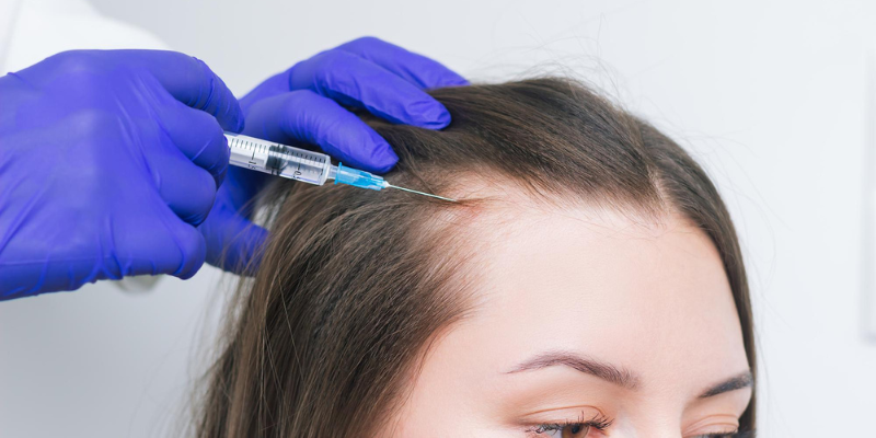 Advancements in Female Hair Transplant Techniques: What's New?