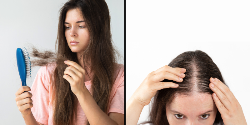 Tried Everything for Hair Loss? These Breakthrough Solutions Might Surprise You