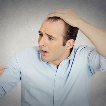 Factors affecting the Hair Transplant Longevity!!