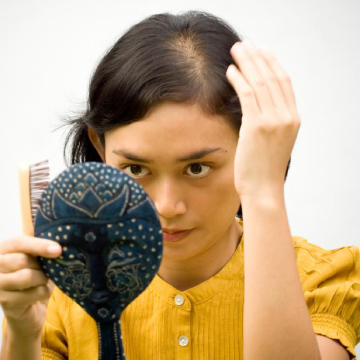 Witnessing Receding Hairline in Your Early 20's? 3 Tested Ways You Can Protect Your Hair