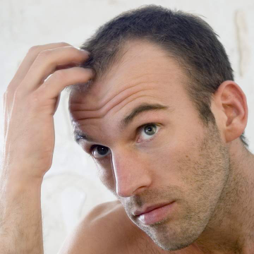 Benefits of Non-Surgical Hair Replacement