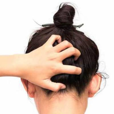 3 Recipes to Deeply Moisturize Dry Scalp