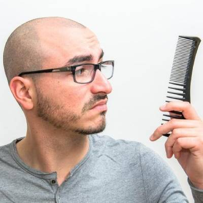 6 Renowned Bald Men in History