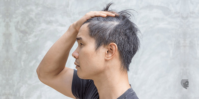 Causes and Remedies for Grey Hair | Advanced Hair Studio