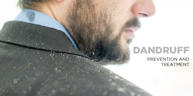 Best Prevention Treatment for Dandruff
