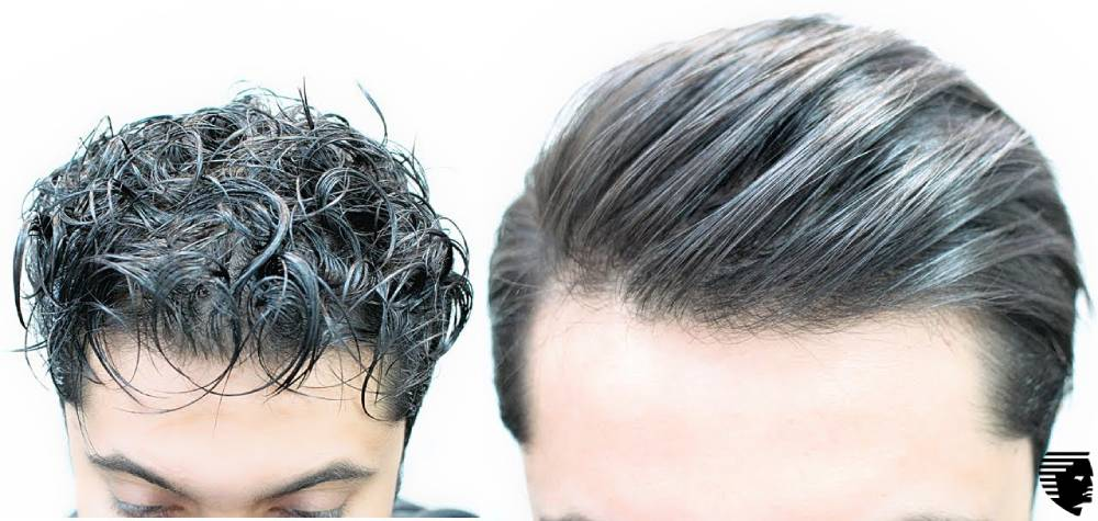 Experts at Hair Transplantation give Suggestions About Keratin Treatment
