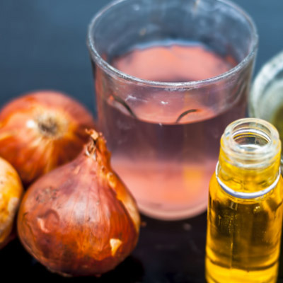 What are the Surprising Benefits of Onion Hair Oil?