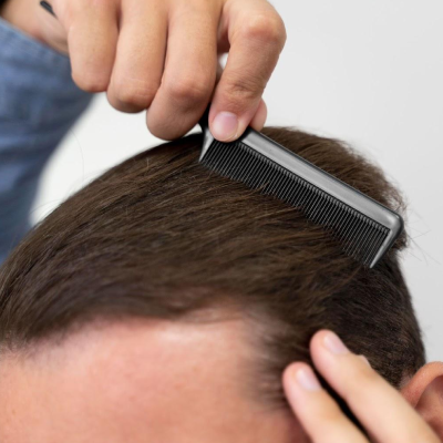 The Most Effective Hair Loss & Hair Transplant Treatment in Hyderabad