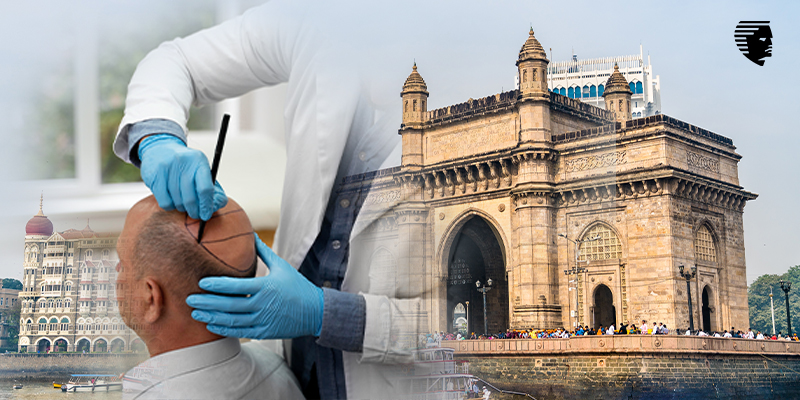 Hair Transplants in Mumbai: Don't Sacrifice Quality for Cost