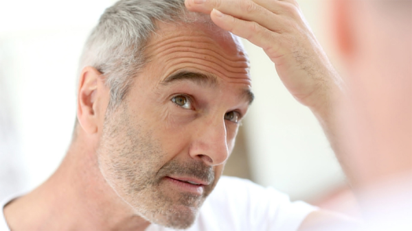 Is hair regrowth possible myth and facts