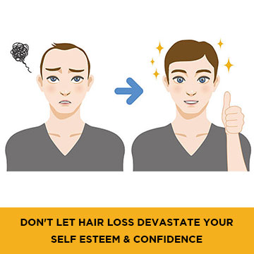 Don't let Hair Loss Devastate your Self Esteem & Confidence