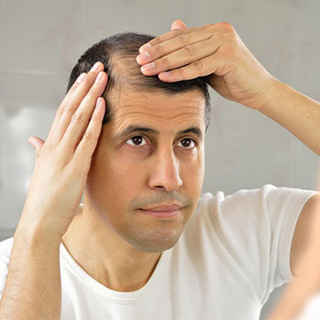 6 Stimulants Of Hair Loss You Should Know About
