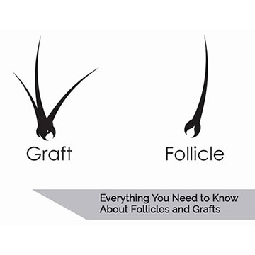 Everything You Need to Know About Follicles and Grafts