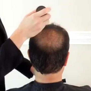 Improve the Appearance of Thinning Hair in Minutes with Hair Loss Fibers