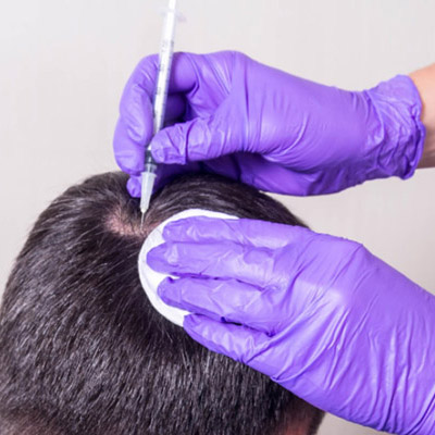 Hair Recovery Tips Post-Transplant Surgery