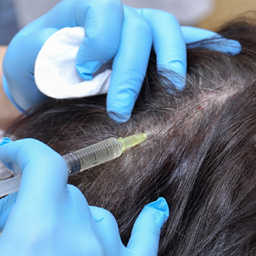 Is PRP (Platelet-Rich-Plasma) Therapy For Hair Restroration A Myth Or An Effective Tool?