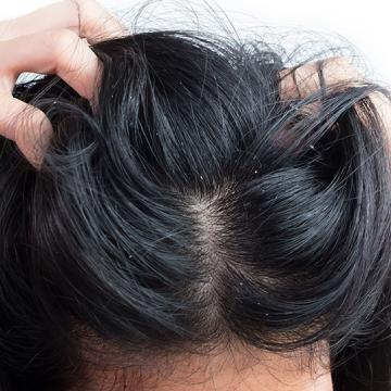 Experiencing an Itchy Scalp? Here’s How to Treat It!