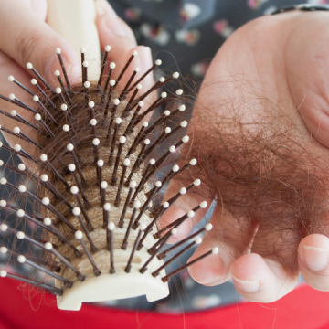 FACING SEASONAL HAIR LOSS? HERE’S WHAT YOU CAN DO ABOUT IT!