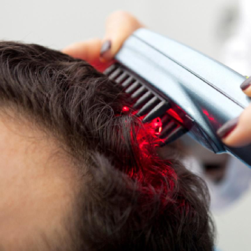 What Makes The Laser Therapy Stand Out When It Comes to Hair Regrowth