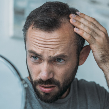 5 Signs That Your Hair Loss is Temporary