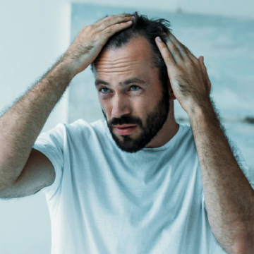 Busting Common Male Hair Loss Myths