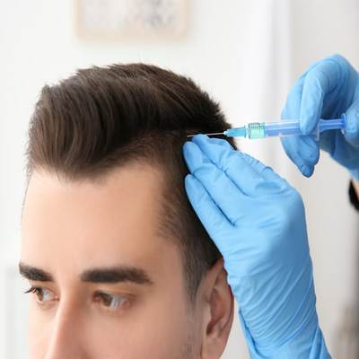 Can Polycystic Ovarian Syndrome (PCOS) Cause Hair Loss?