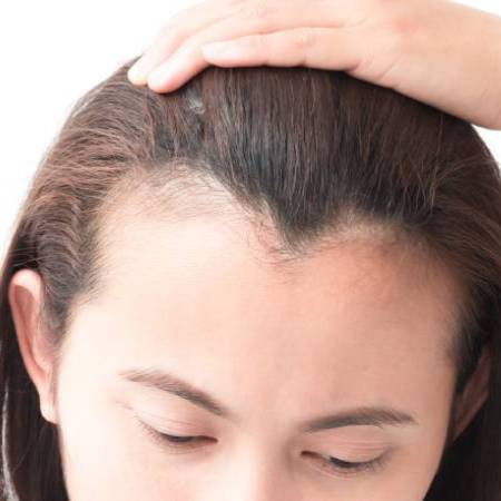 How to Fight Traction Alopecia?