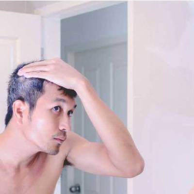 Ultimate Guide to Hair Loss Conditions