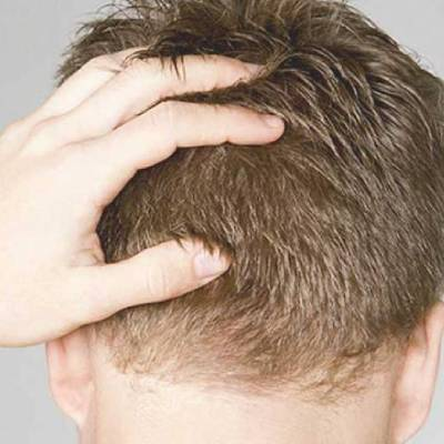 The Most Strange Hair Restoration Misconceptions Debunked