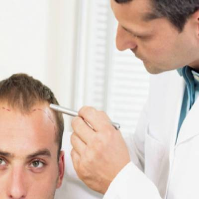 5 Tips to Stay Away from Dishonest Hair Transplant Doctors