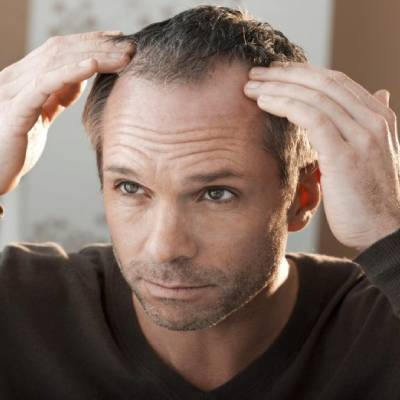 Some Effective Ways to Treat Hair Loss Caused by Hormonal Imbalance