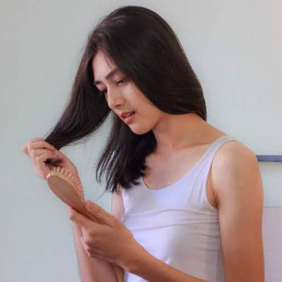 Some Unexpected Hair Loss Statistics That Could Surprise You