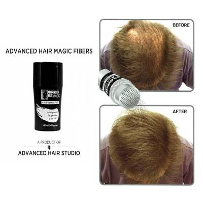 Hair Fibres are Actually Helping People who are Suffering from Hair Thinning