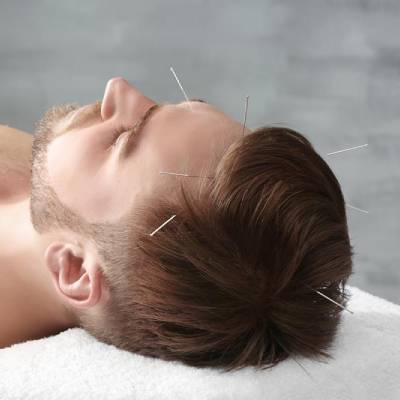 Can Acupuncture Really Affect Hair Growth?