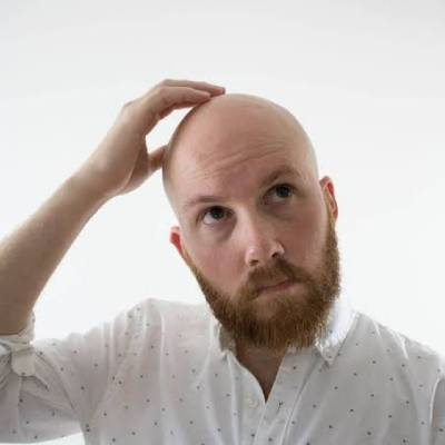 Pros & Cons of Getting Bald