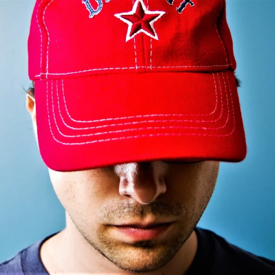 Stop "Hatfishing" to hide your bald spot & get the right hair treatment at Advanced Hair Studio