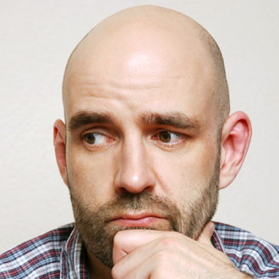 Genetics used to find out if you will get bald in the future!