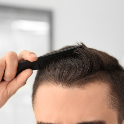 Hair loss at an early age? The first sign that your youth is fading