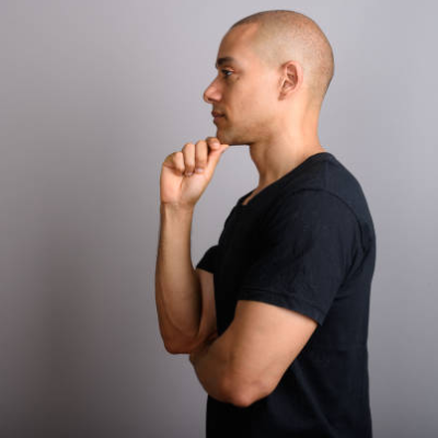 Is accepting your baldness the only option left for you?
