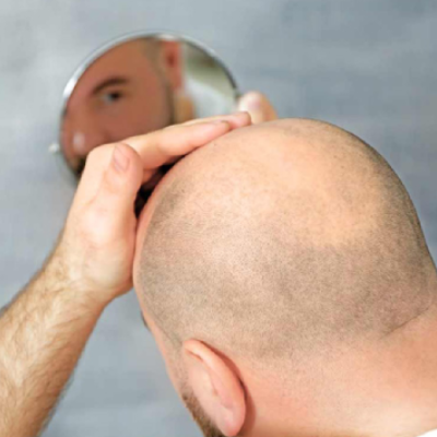 Don't let your appearance hold you back anymore! Regain your confidence with Advanced Hair Studio