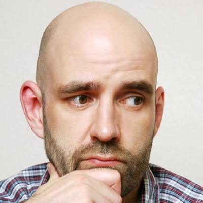 Bald spot ruining your perfect selfie