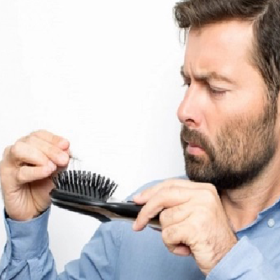 4 Medical Reasons Which Might Lead to Permanent Hair Loss