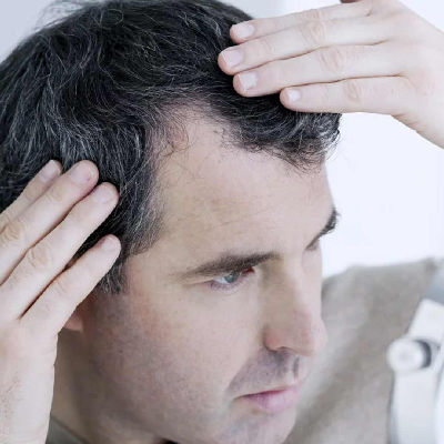 Activities You Can Do While performing Your FUE