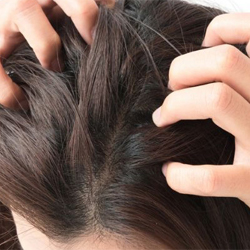 What are the Reasons for an Itchy Scalp?